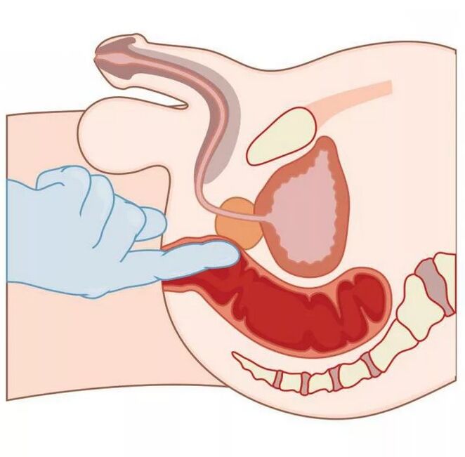 Lalaki nga lokasyon sa G-spot